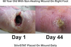 SilvrSTAT First Aid Kit Gel, 32 PPM Silver Healing Wound Dressing Solution, SilverSol Ag₄O₄ Particles, 3 oz