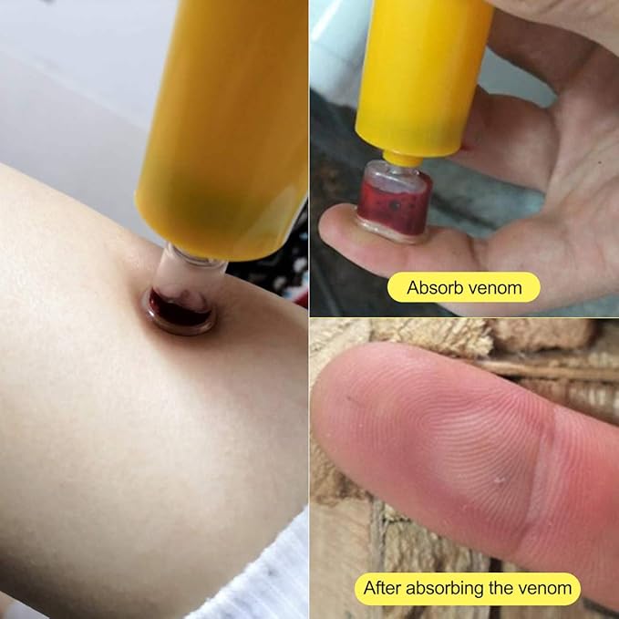 Snake Bite Kit, Bee Sting Kit, Emergency First Aid Supplies, Venom Extractor Suction Pump, Bite and Sting First Aid for Hiking, Backpacking and Camping