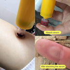 Snake Bite Kit, Bee Sting Kit, Emergency First Aid Supplies, Venom Extractor Suction Pump, Bite and Sting First Aid for Hiking, Backpacking and Camping