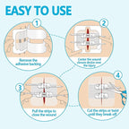 Senvok Emergency Wound Closure Device 4 Pcs - Upgraded Zip Stitch Wound Closure Strips - Butterfly Bandages Laceration Closure Strips for Quick, Painless, Stitchless Wound Closure