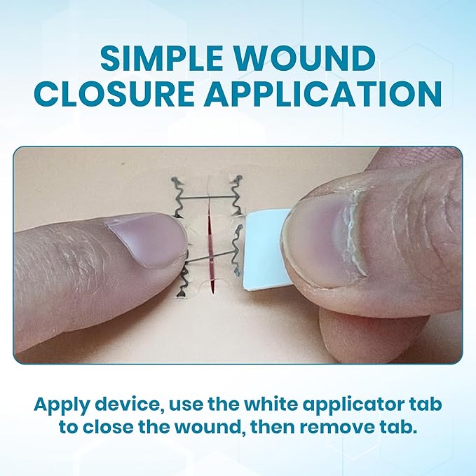 Emergency Wound Closures - Surgical-Grade Laceration Repair Without Stitches | Skin Closure Alternative to Butterfly Bandages | First Aid Kit Essential (6 Medium Wound Closure Devices)
