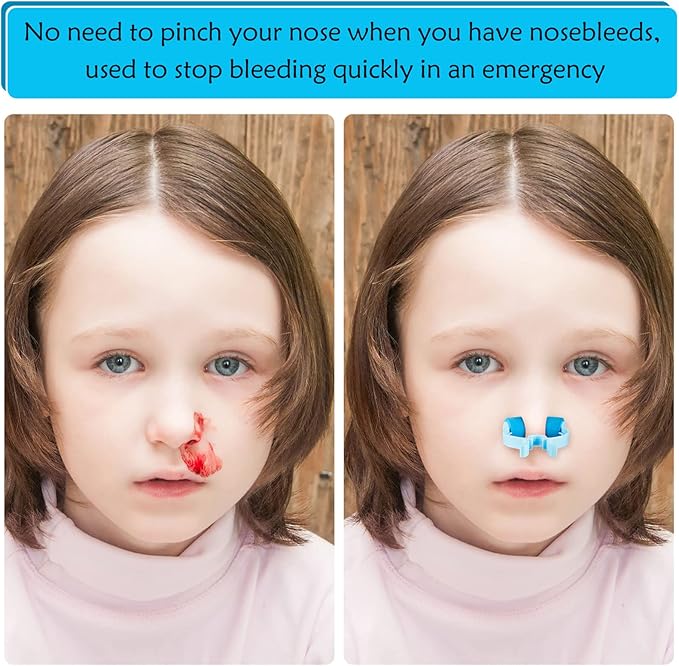 Frienda Professional Nose Stop Clips Plastic Foam Nosebleed Stopper Clips for Adults Accidental Emergency Condition Swimming(60 Pcs,Blue,Standard Size)