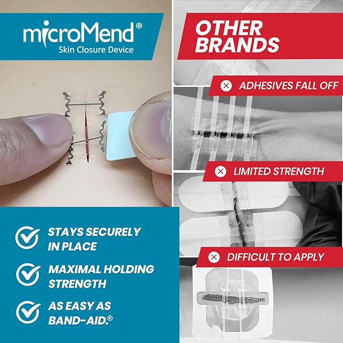 Emergency Wound Closures - Surgical-Grade Laceration Repair Without Stitches | Skin Closure Alternative to Butterfly Bandages | First Aid Kit Essential (6 Medium Wound Closure Devices)