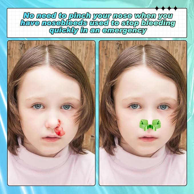 Frienda Professional Nose Stop Clips Plastic Foam Nosebleed Stopper Clips for Adults Accidental Emergency Condition Swimming(60 Pcs,Green,Standard Size)